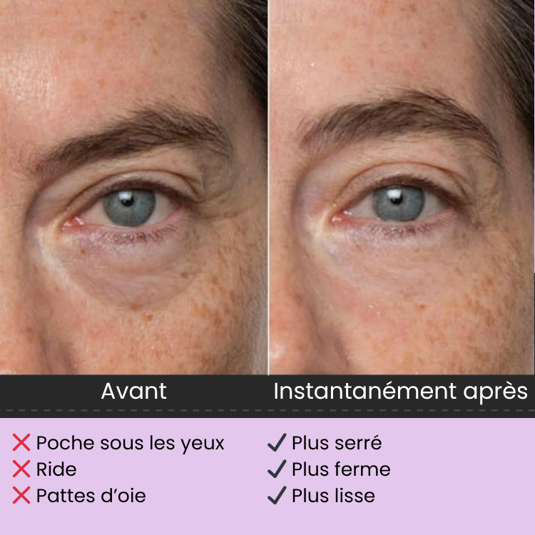 Soin effet liftant immédiat